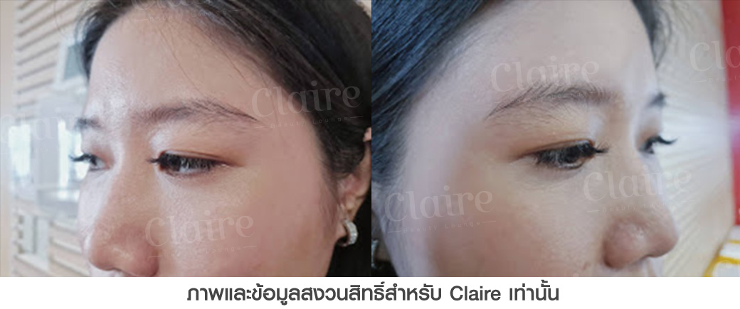 ฝังสีคิ้วClaire-สักคิ้ว