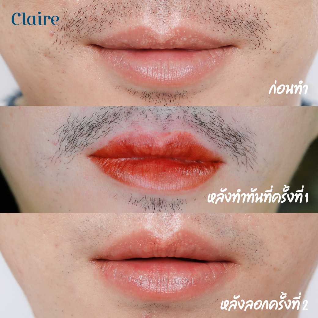 รีวิวสักปาก,สักปาก,รีวิวฝังสีปาก,ฝังสีปาก,สักปากclaire,ฝังสีปากclaire