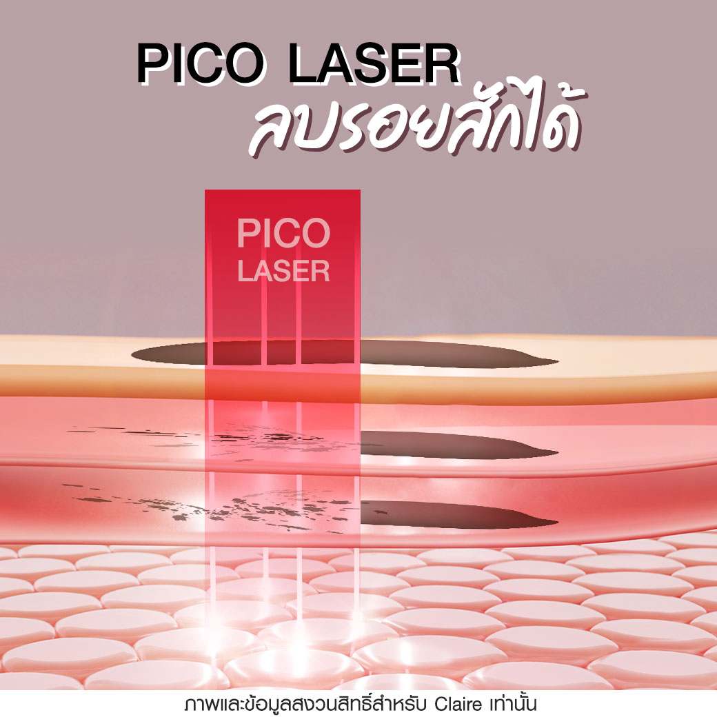 ลบรอยสัก,วิธีลบรอยสัก,ลบรอยสักคิ้ว,ลบรอยสักที่ไหนดี,pico laser ลบรอยสัก,laser ลบรอยสัก,ฝังสีคิ้ว,สักคิ้ว,ฝังสีคิ้วClaire,ลงสีคิ้วClaire